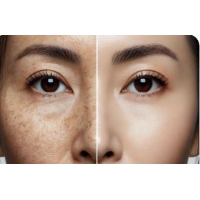 LEKE SETI 5 LI PARCA TAM PAKET LEKE SETI 5 LI PARCA TAM PAKET