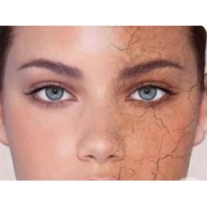 CILT KURULUGU VE HASSAS CILTLERE OZEL 4 LU SET