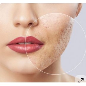 AYDINLATICI RENK DÜZENLEYICI KREM