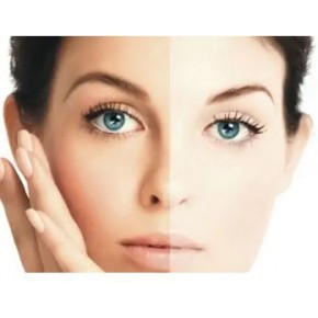 YUZ BEYAZLATMA SERUMU YUZ BEYAZLATMA SERUMU